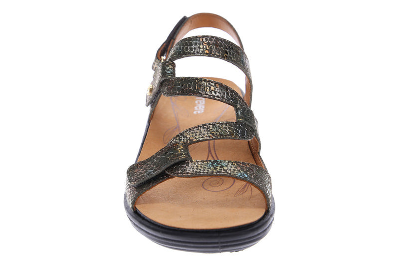 plantar fasciitis