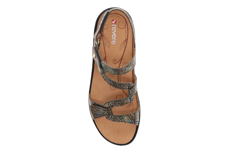 bunions