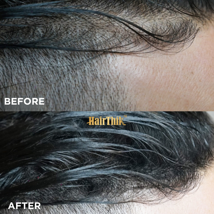 Supreme Trimmer HairThik 55g Hair Fibers Before and After Hairline and Thinning Hair Enhancement Results