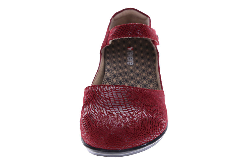 plantar fasciitis