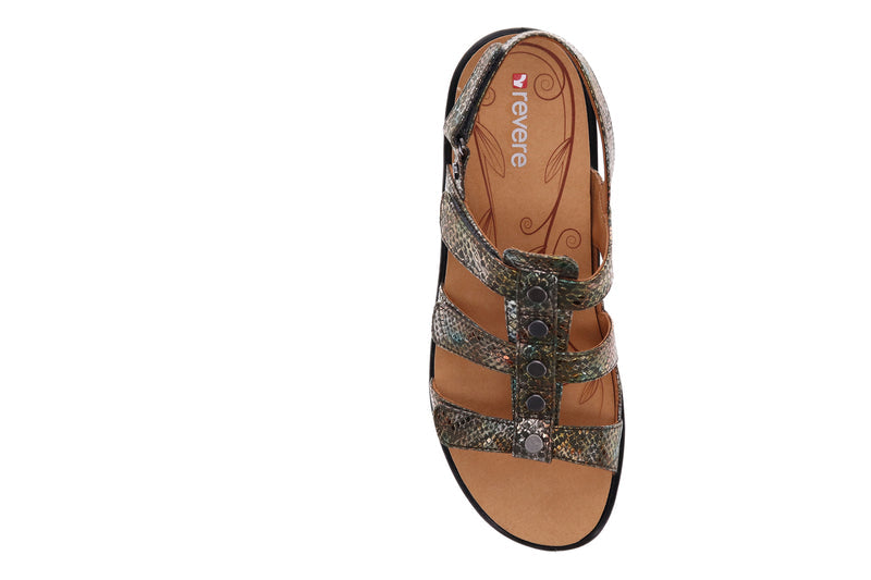 bunions